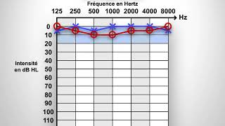Audiogramme [upl. by Vona]