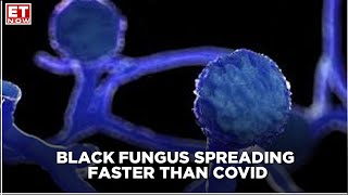 MUCORMYCOSIS IS SPREADING 80 TIMES FASTER THAN COVID [upl. by Venator]