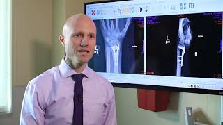 Broken Wrists Fracture Types Treatment Options amp Recovery  Dr Froelich [upl. by Aikram]