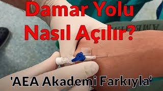 Damar Yolu Nasıl Açılır [upl. by Anasiul]