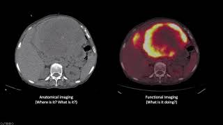 How radiopharmaceuticals help diagnose cancer and cardiovascular disease [upl. by Llirret]