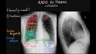 Radio du thorax  Introduction  Partie 1  Docteur Synapse [upl. by Tirma861]