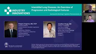 Interstitial Lung Diseases An Overview of Progression and Radiological Features [upl. by Noira]