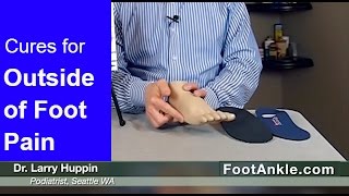 How to Treat Pain on the Outside of the Foot with Seattle Podiatrist Dr Larry Huppin [upl. by Chenay664]