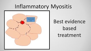 Myositis Inflammatory Myopathy Treatment [upl. by Suiramaj]