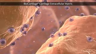 BioCartilage® Cartilage Extracellular Matrix [upl. by Gladi]