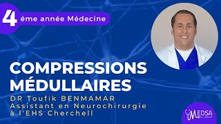 Compressions Médullaires  DR Toufik BENMAMAR [upl. by Sou]