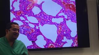 Basics of interstitial lung disease pathology explained by a pulmonary pathologist [upl. by Lusar]