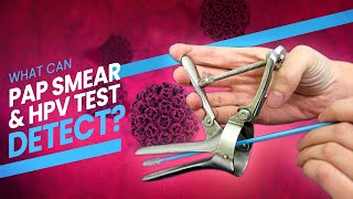 Pap Smear Pap Test and HPV Test  A step by step guide 3D at what happens during the test [upl. by Anived]