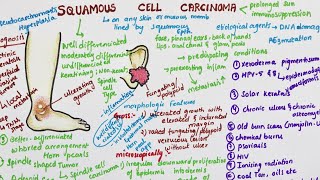 Understanding Squamous Cell Carcinoma [upl. by Ellivro27]