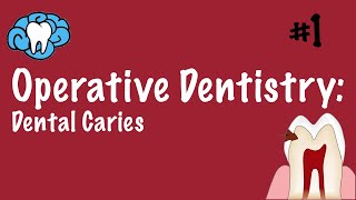 Operative Dentistry  Dental Caries  INBDE ADAT [upl. by Liahkim650]