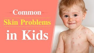 6 Common Skin Problems in Children [upl. by Asenev337]