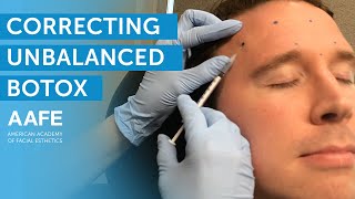 BOTOX® Injection  Forehead Wrinkles and Frown Lines  Atlanta Botox® [upl. by Tandi536]