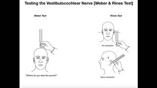 Interpreting the WeberRinne Tests EXPLAINED [upl. by Seuqirdor]