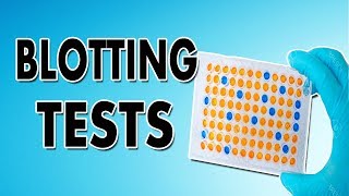 Blotting Techniques Western Blot Southern Blot and Northern Blot [upl. by Eelloh627]