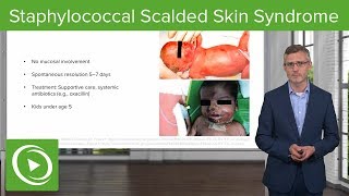 Staphylococcal Scalded Skin Syndrome – Dermatology  Lecturio [upl. by Aneekan]