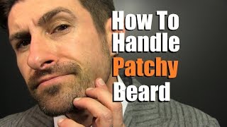 How To Deal With A Patchy Beard  Bald Spot Reduction Tips [upl. by Ormond]