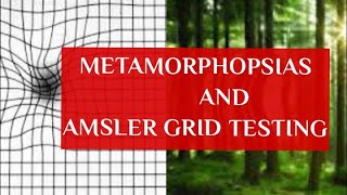 METAMORPHOPSIAS and AMSLERS GRID TESTING [upl. by Acemaj]