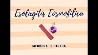 Candida Esophagitis [upl. by Rednirah]