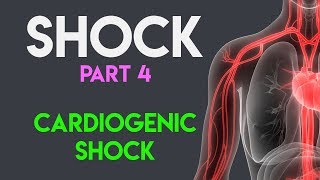 Cardiogenic Shock  Shock Part 4 [upl. by Onairpic]