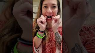 Most HONEST Review of Pop On Veneers You must watch this if youre thinking of getting veneers [upl. by Anoerb822]