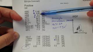 Hematology How to interpret automated Complete Blood Count CBC results [upl. by Eimam]