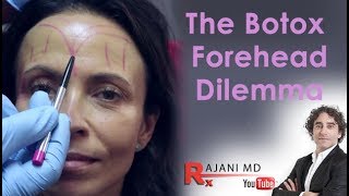 Botox Forehead Dilemma Explained Dr Rajani [upl. by Britte]