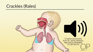 Respiratory Assessment by B Leary L DelSignore  OPENPediatrics [upl. by Aronael888]