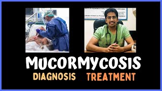 MUCORMYCOSIS Clinical features Diagnosis amp Treatment [upl. by Oibaf]