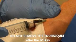 IV Insertion with Lab Draw [upl. by Ahsoek260]