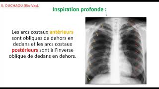 Comment interpréter une radiographie thoracique de face  Partie 1 [upl. by Constancia]