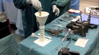 TKA Bone Cement Technique [upl. by Olegnalehcim]