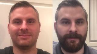 2 Month Beard Time Lapse [upl. by Adnih]