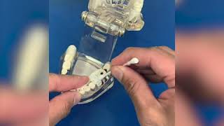 How to use temporary dental filling material [upl. by Eicyal]