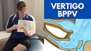 EXAMPLE DIX HALLPIKE MANEUVER TO DIAGNOSE BPPV DIZZINESS [upl. by Ailama945]