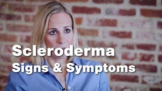 Signs and Symptoms of Scleroderma  Johns Hopkins [upl. by Rap739]