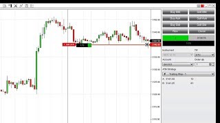 Configure an Automatic Trailing Stop [upl. by Harden]