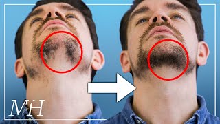 How To Fix Your Patchy Beard… Fast [upl. by Sinnaiy]