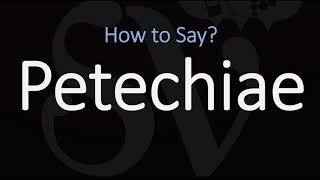 How to Pronounce Petechiae CORRECTLY Meaning amp Pronunciation [upl. by Yelhs]