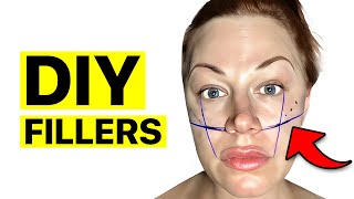 DIY Cheek Filler How I Did Cheek Filler At Home  Surgeon Reacts [upl. by Arrekahs]