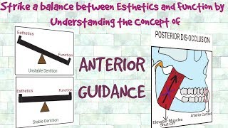 Anterior Guidance  Understanding the Concept [upl. by Al]