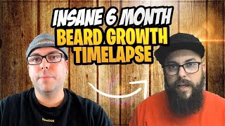 Beard Growth Time Lapse Patchy [upl. by Lenes]