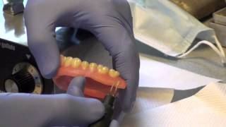 Denture Soft Reline Part 2 [upl. by Odla]