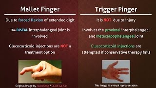 Mallet Finger Explained by Dr Alexander Anzarut [upl. by Jeffy650]