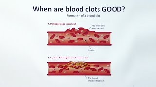 Anticoagulants [upl. by Sup]