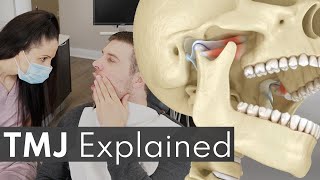 TMJ Explained  Jaw Pain Causes amp Symptoms [upl. by Richart]