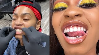 Smiley Piercing Vlog [upl. by Anolahs589]