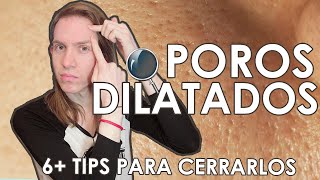 POROS DILATADOS  Como mejorarlos [upl. by Akcir]