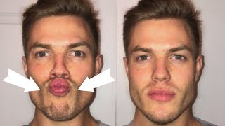 3 Exercises To Lose CHUBBY Cheeks Get a Defined Face [upl. by Nesmat]