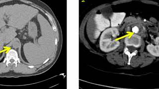 Introduction to Radiology Computed Tomography [upl. by Llehcam]